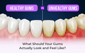 Healthy Gums vs. Unhealthy Gums: What Should Your Gums Actually Look and Feel Like?
