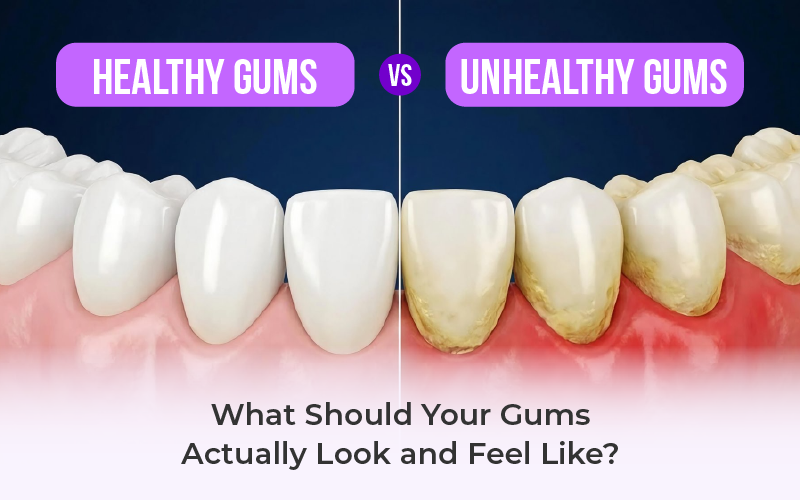 Healthy Gums vs. Unhealthy Gums: What Should Your Gums Actually Look and Feel Like?