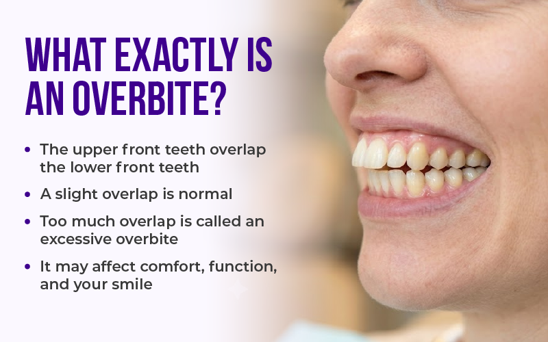 What Exactly Is an Overbite?