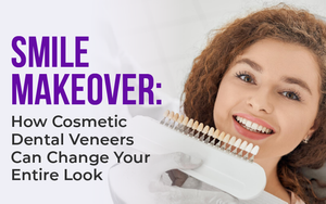 Smile Makeover: How Cosmetic Dental Veneers Can Change Your Entire Look