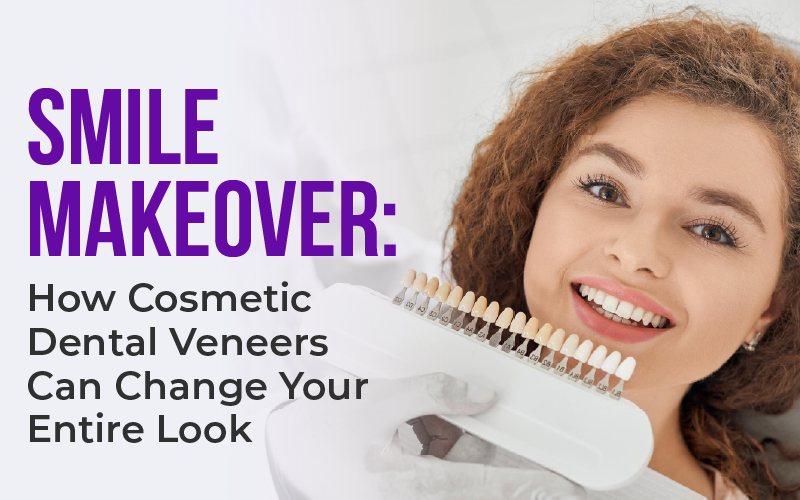 Smile Makeover: How Cosmetic Dental Veneers Can Change Your Entire Look