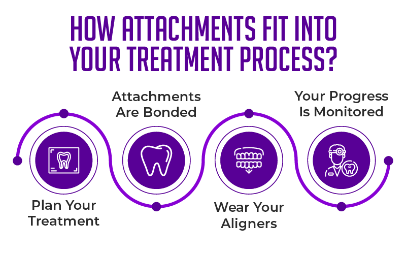 How Invisalign Attachments Fit Into the Invisalign Treatment Process
