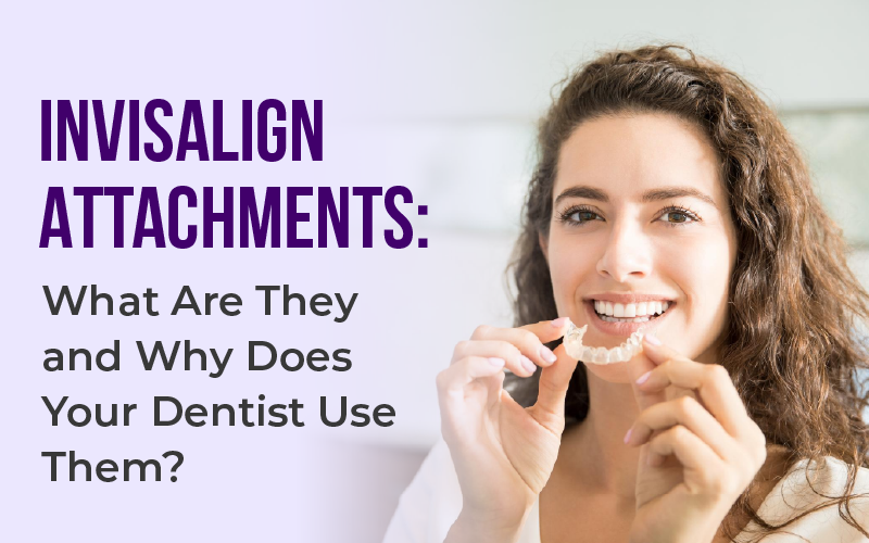 Invisalign Attachments: What Are They and Why Does Your Dentist Use Them?