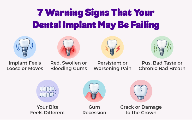 7 Warning Signs That Your Dental Implant May Be Failing