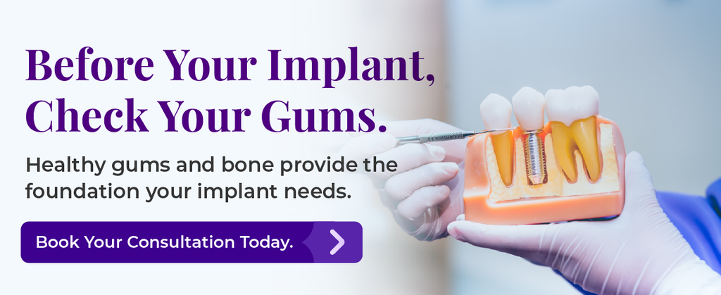 Before Your Implant, Check Your Gums.