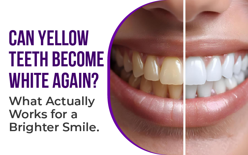 Can Yellow Teeth Become White Again? What Actually Works for a Brighter Smile
