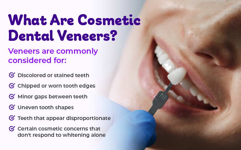 What Are Cosmetic Dental Veneers?