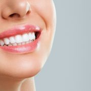 teeth-whitning-femal-smile